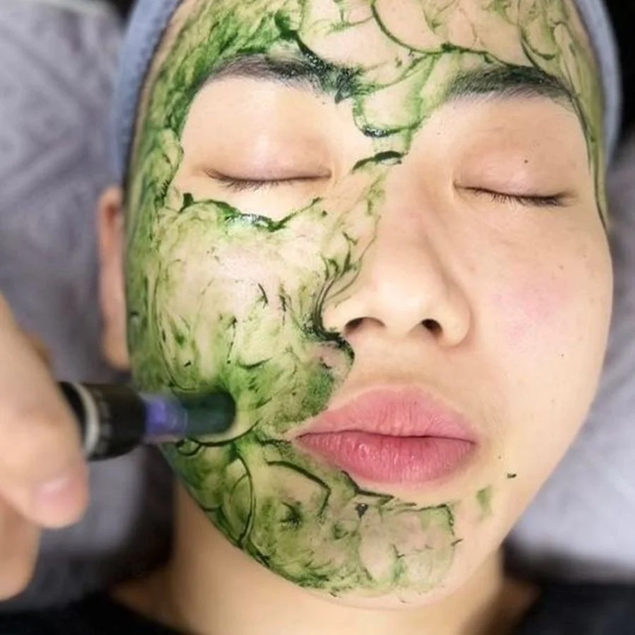 Cấy tảo da mặt 20 Dịch vụ Cấy tảo da mặt tại K.T Care Spa