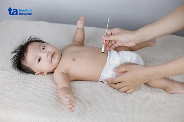 Bố mẹ nên mặc tã phía dưới rốn, làm khô rốn để rốn tiếp xúc nhiều với không khí và nhanh khô