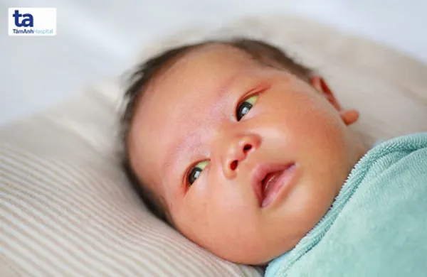 Mặt và củng mạc