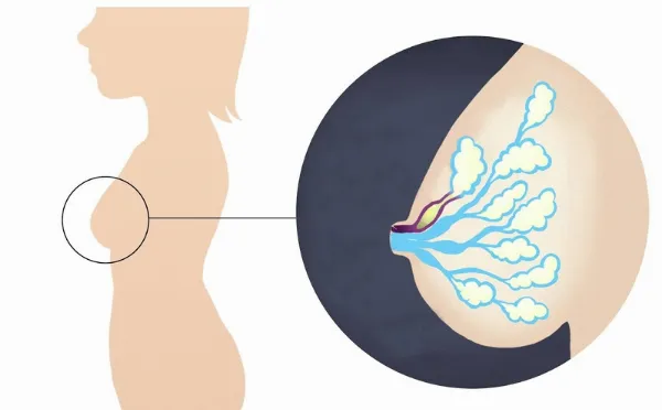 Nguyên nhân tắc tia sữa thường gặp ở mẹ sau sinh