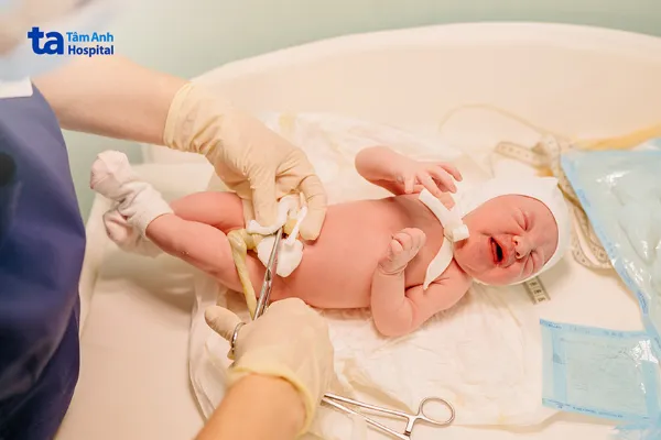 Sau khi trẻ sinh ra dây rốn không còn cần thiết nên sẽ được bác sĩ cắt đi, chỉ còn lại cuống rốn sẽ tự teo lại và rụng đi